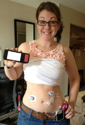 Turning Diabetes Over to the Bionic Pancreas