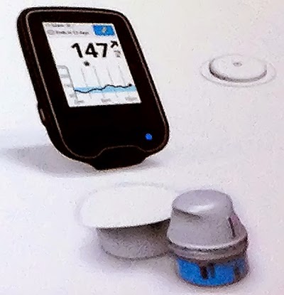 Savvy Updates 8/4/18: Omnipod, Abbott Libre, Man Cured of T1?, Metronom Health