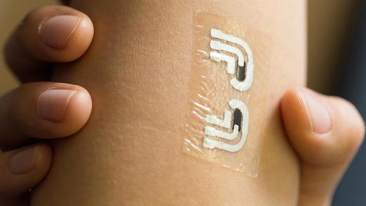 CNBC: A ‘tattoo’ may end fingerpricks for diabetics