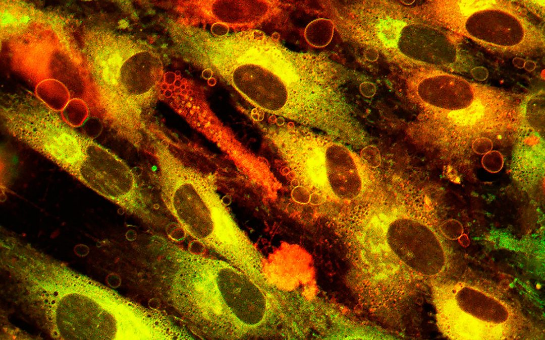 Be Savvy About Injuries – Better to Get Hurt in the Daytime!