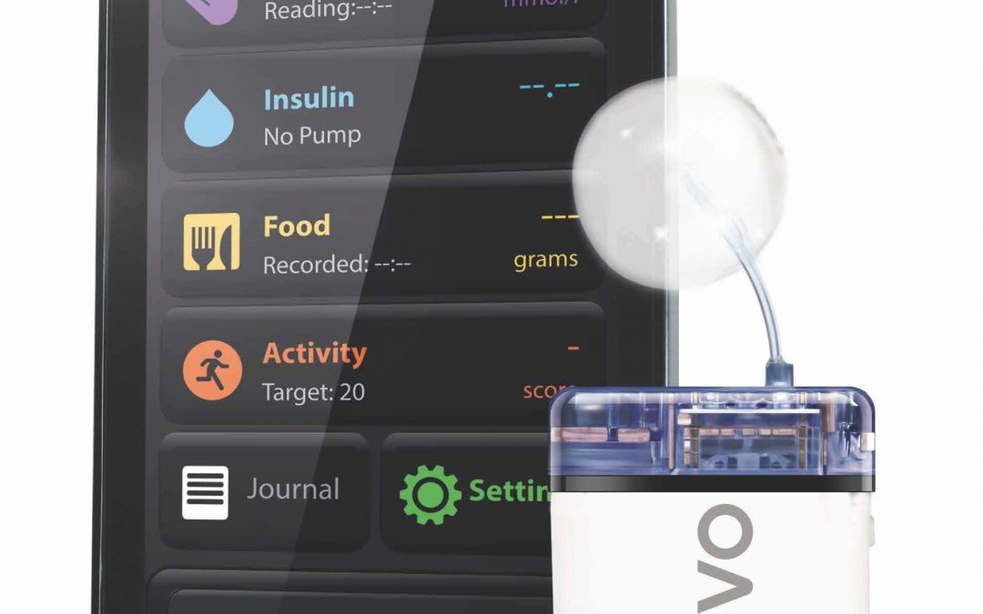 Savvy Updates, 4/1/19: Beta Cell Destruction, Patch Pumps (EoPancreas & CellNovo), Integrated Medical Sensors, Insulin Dosing and AI, Hospital-based AP