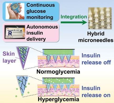 Savvy Updates, 7/27/20: Lower Insulin Costs for Medicare, Microneedle Insulin Patch, Single vs. Dual Hormone AP