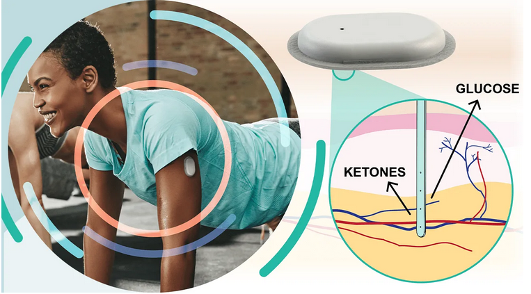 Savvy Updates, 11/30/20:  CGM + K(etones) Sensor