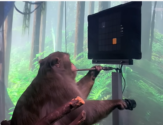 Savvy Updates, 6/7/21:  Senseonics soars, Brain implants enhance memory capabilities