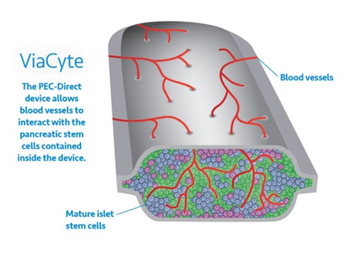 Savvy Updates, 7/5/21: Nano Tech & Microneedle Patches, Walmart’s ReliOn Novolog ($72/bottle!), Bijels, Islet Transplant News, Symlin & Insulin,