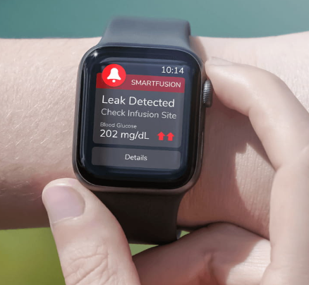 Savvy Updates, 9/25/23: Vaccine to Reverse T1D, Seraxis Cell Therapy, Medtronic Simplera CGM, Diatech Diabetes SmartFusion Uses AI to Detect Infusion Failures, DotCool Fridge Sensor, Spinach Extract Heals Wounds, Novo/Ypsomed Partner for AutoInjectors, FREE Covid Tests Again