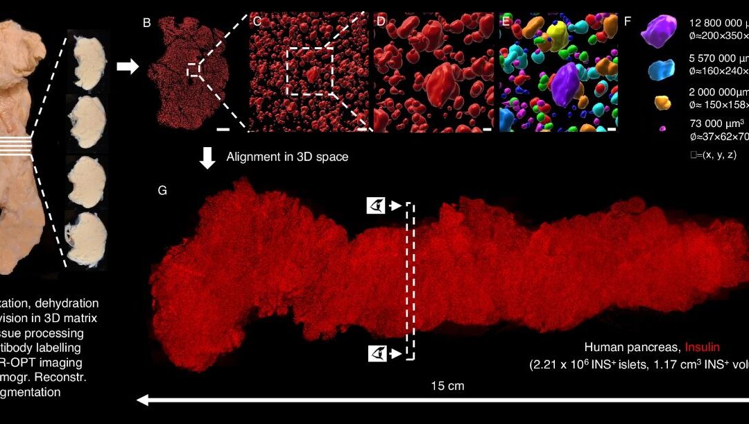 Savvy Updates, 4/29/24:  Cadisegliatin Regulates BG in Liver, Diabetes Driving Pal App, Female Physicians Result in Better Health Outcomes, UHC Data Breach “Substantial”, Pancreas Anatomy Image, Little Sleep Risky for T1D Teens, Vertex/TreeFrog Collab, Mounjaro/Zepbound Shortages, Ozempic in Denmark, Roasted Green Tea (houjicha)