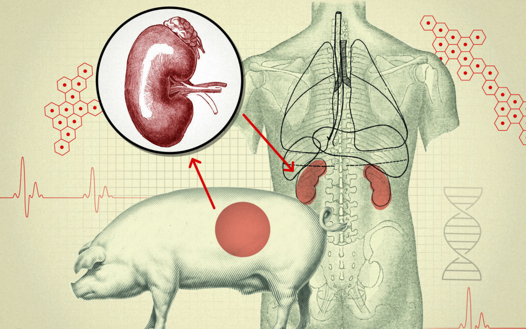 Savvy Updates 4/1/24: Pig Kidney Transplanted into Human, Mini Dose with Glucagon, Sleep Apnea & T1D, 15% Medical Claims Denied,AMA Urged by Congress, Why Melted Cheese Tastes GOOD